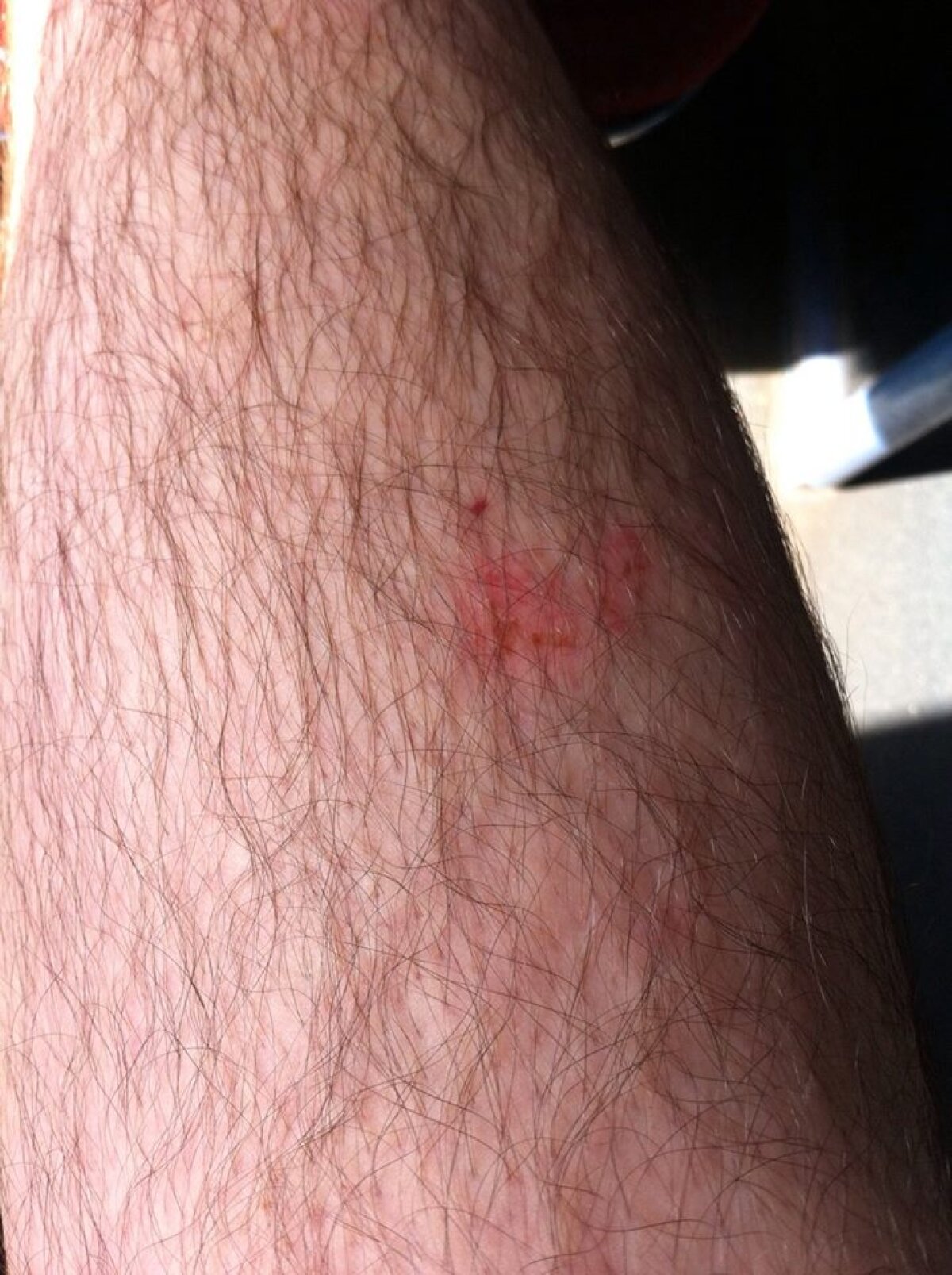 GALERIE FOTO Pericol de accidentare pe stadion din Liga 1 » Un fan a ieșit cu răni de la Tribuna 0