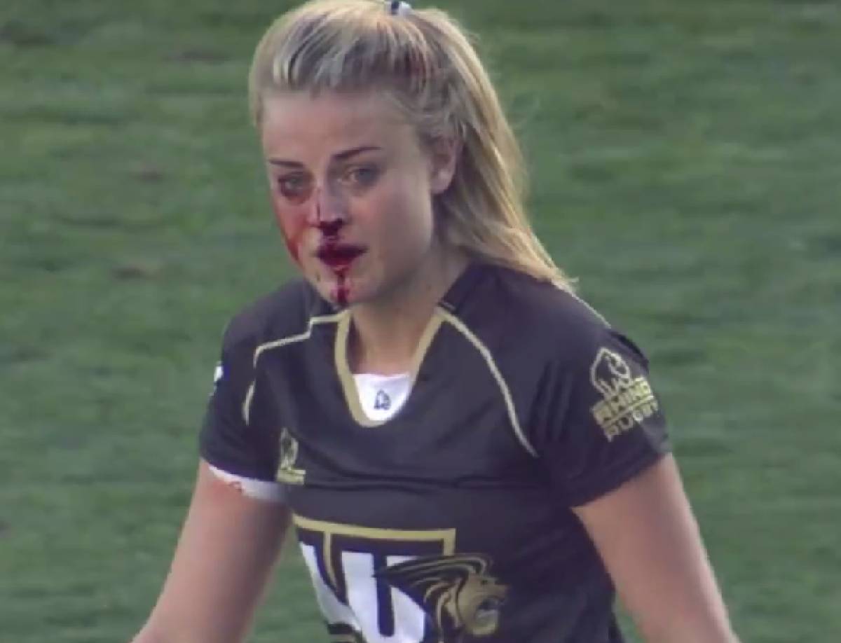 Șocant! Prințesa războinică » I-a fost spart nasul, însă a continuat să joace