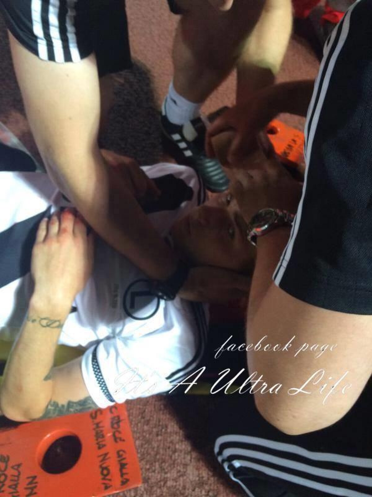 VIDEO și FOTO Incidente sîngeroase în Albania! Meciul Kukesi - Legia a fost abandonat, un jucător lovit cu o piatră în cap, haos în tribune