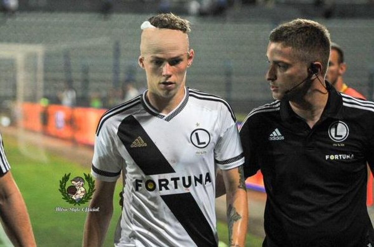 VIDEO și FOTO Incidente sîngeroase în Albania! Meciul Kukesi - Legia a fost abandonat, un jucător lovit cu o piatră în cap, haos în tribune