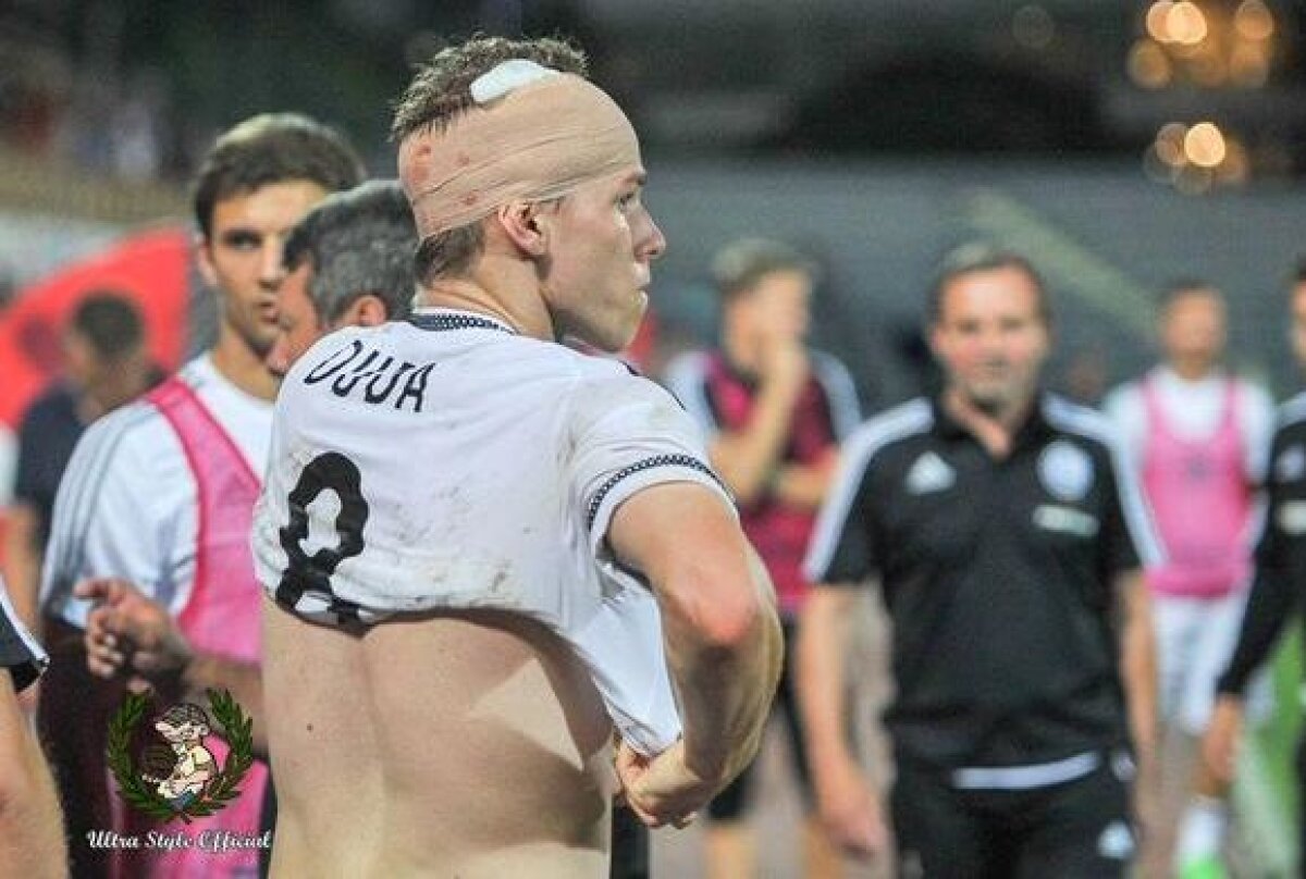 VIDEO și FOTO Incidente sîngeroase în Albania! Meciul Kukesi - Legia a fost abandonat, un jucător lovit cu o piatră în cap, haos în tribune