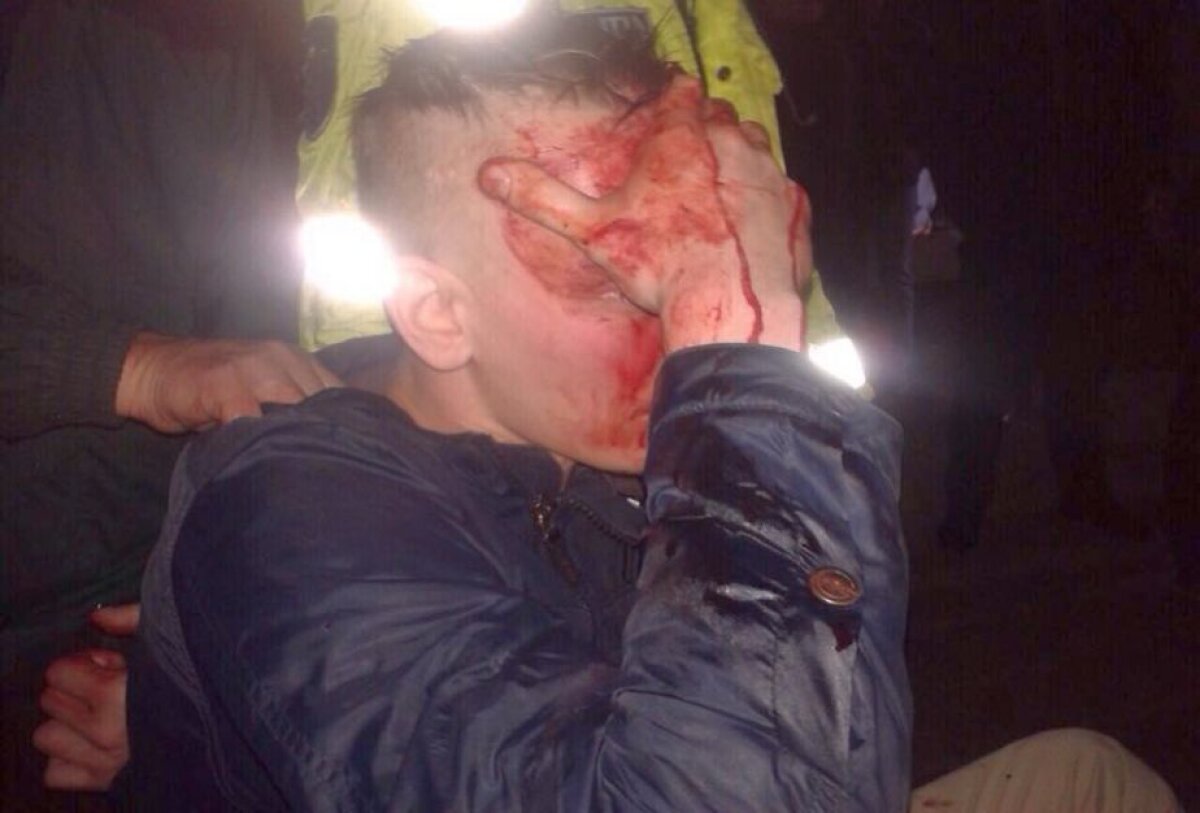 Atenție, imagini șocante! Fanii ruși s-au luat la bătaie cu moldovenii » Incidentele s-au lăsat cu victime pline de sînge