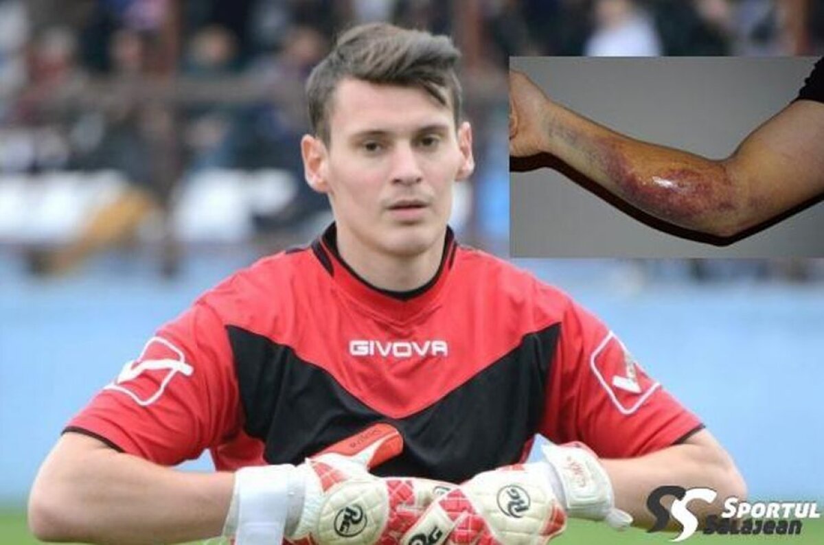 FOTO Atenție, imagini dure! Accidentare groaznică în fotbalul românesc » Cum arată antebrațul unui portar după ce a fost călcat cu crampoanele