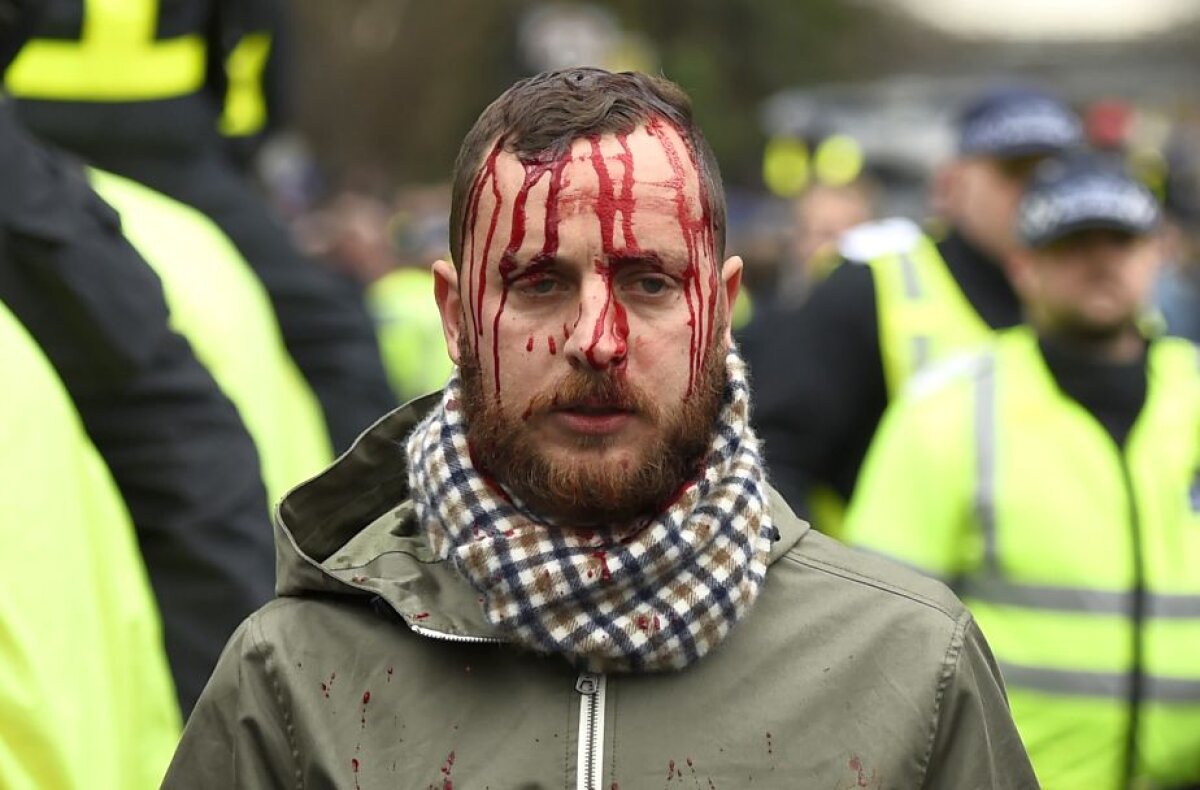 VIDEO + FOTO Atenţie, imagini violente pe străzile din Londra » Bătaie între fanii lui Tottenham și cei ai lui Arsenal 