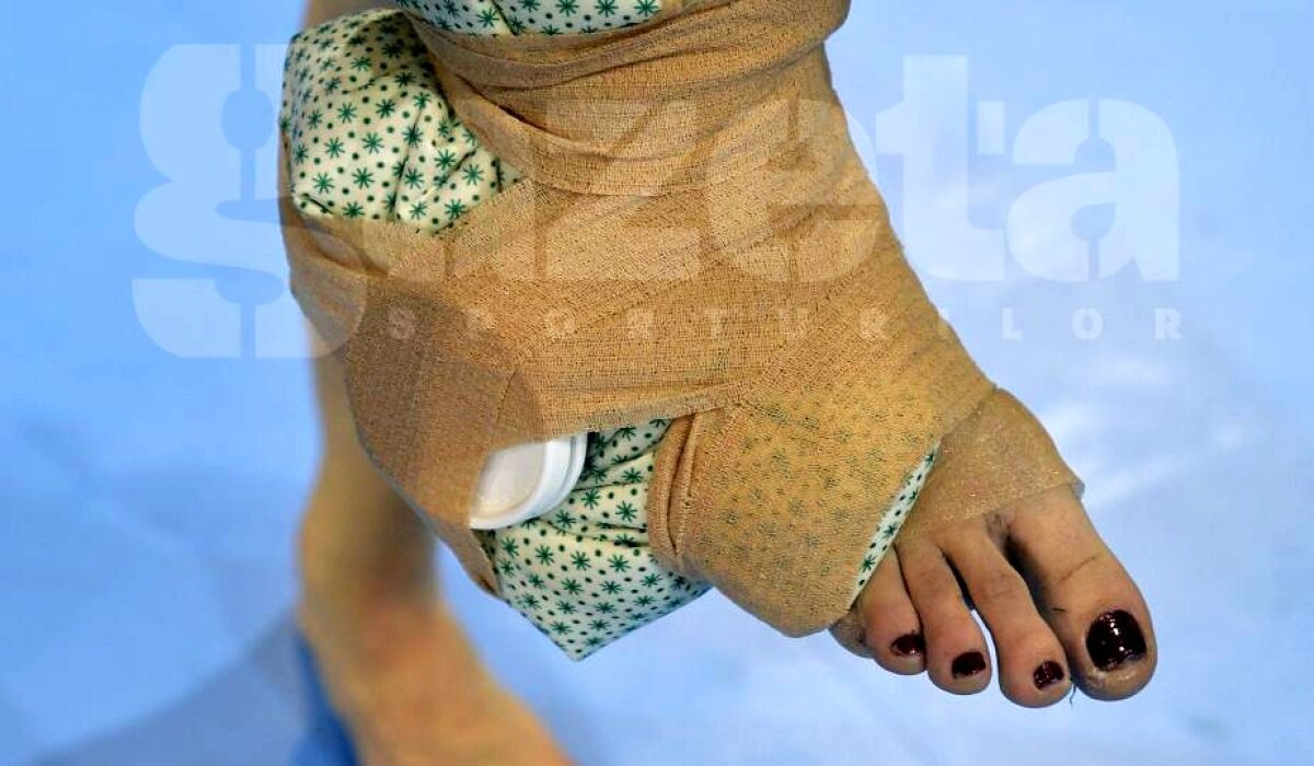 EXCLUSIV FOTOGRAFIE MONUMENT Cea mai bună jucătoare a României a jucat într-un picior! Cum arată glezna Elizei Buceschi după meciul cu Danemarca