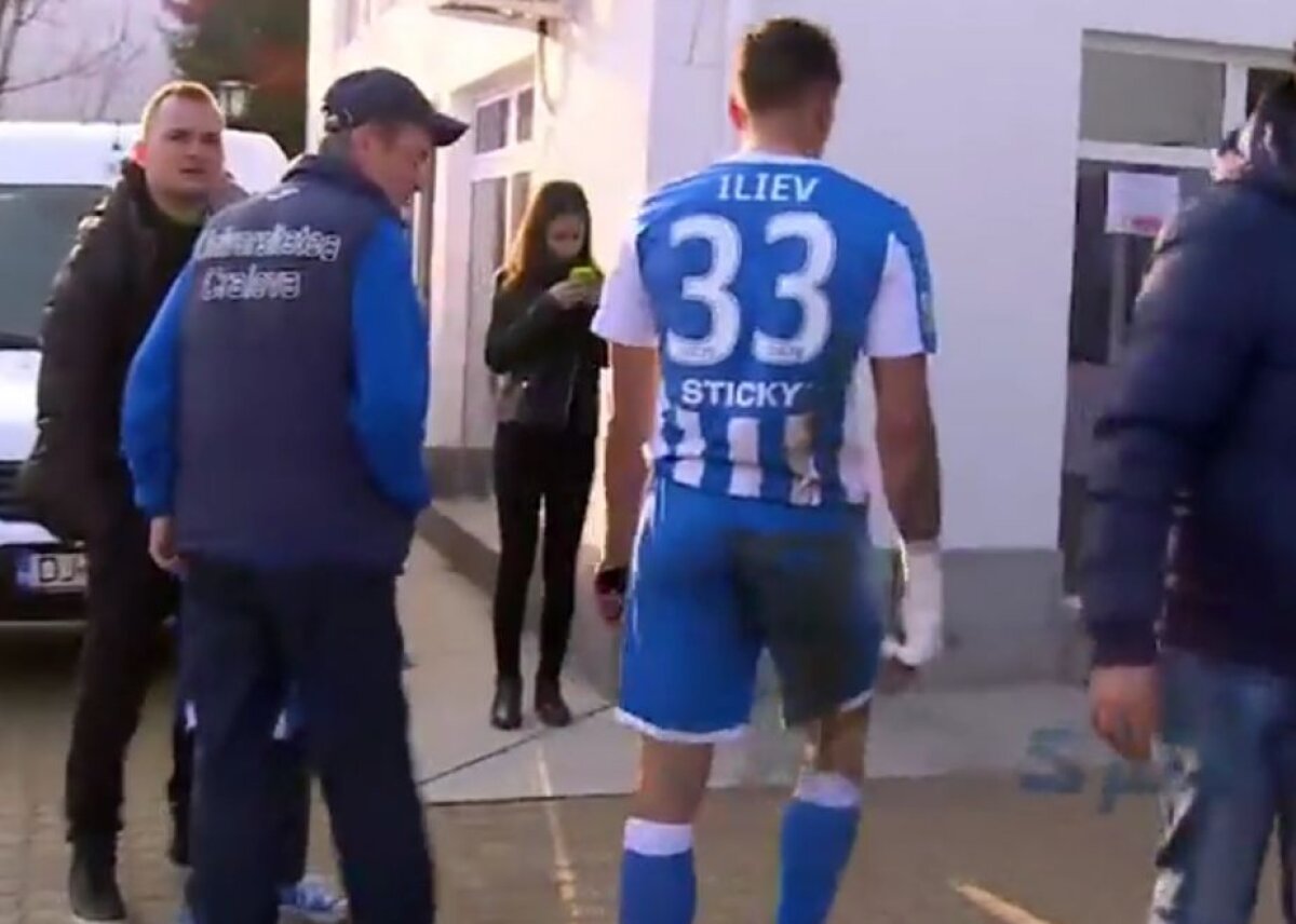FOTO Un nou caz Rădoi » Un fotbalist de la Craiova s-a răzbunat pe geamul ușii de la vestiar și a ajuns la spital