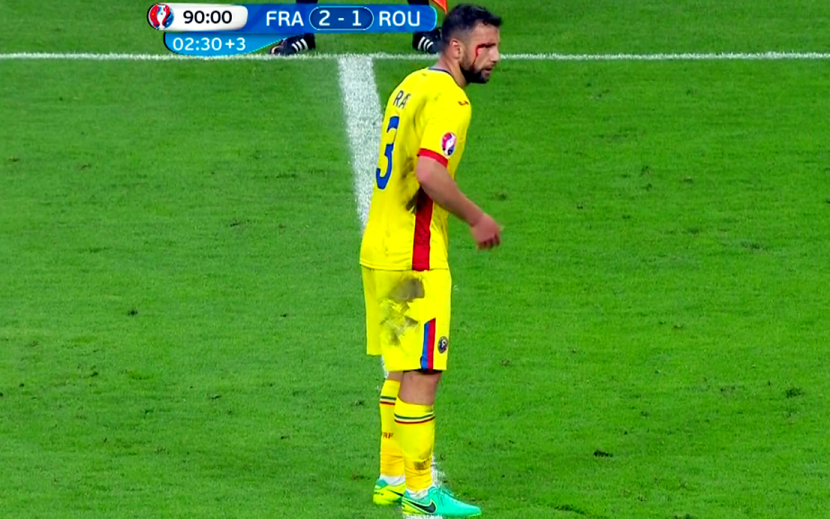 FOTO Imagini dure cu Răzvan Raț » A ieșit de pe teren cu sânge pe față