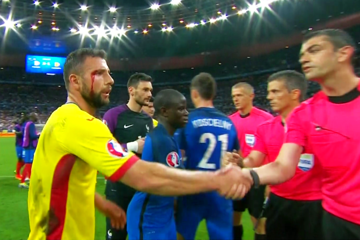 FOTO Imagini dure cu Răzvan Raț » A ieșit de pe teren cu sânge pe față