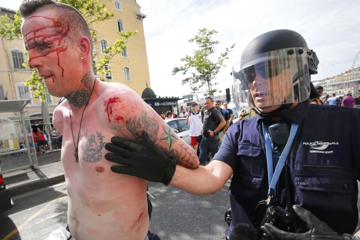 FOTO Lupte de stradă la Marseille! Fanii Angliei, bătuți crunt de ruși, unul este în stare extrem de gravă » Atenție, imagini cu un puternic impact emoțional!