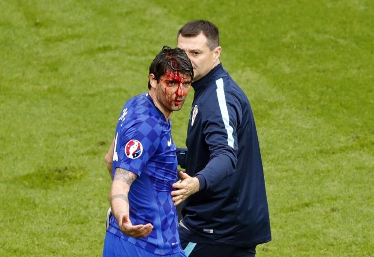 FOTO Imagini șocante cu Vedran Corluka! Ce a pățit fundașul croat în meciul contra Turciei 