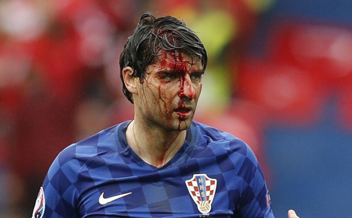 FOTO Imagini șocante cu Vedran Corluka! Ce a pățit fundașul croat în meciul contra Turciei 