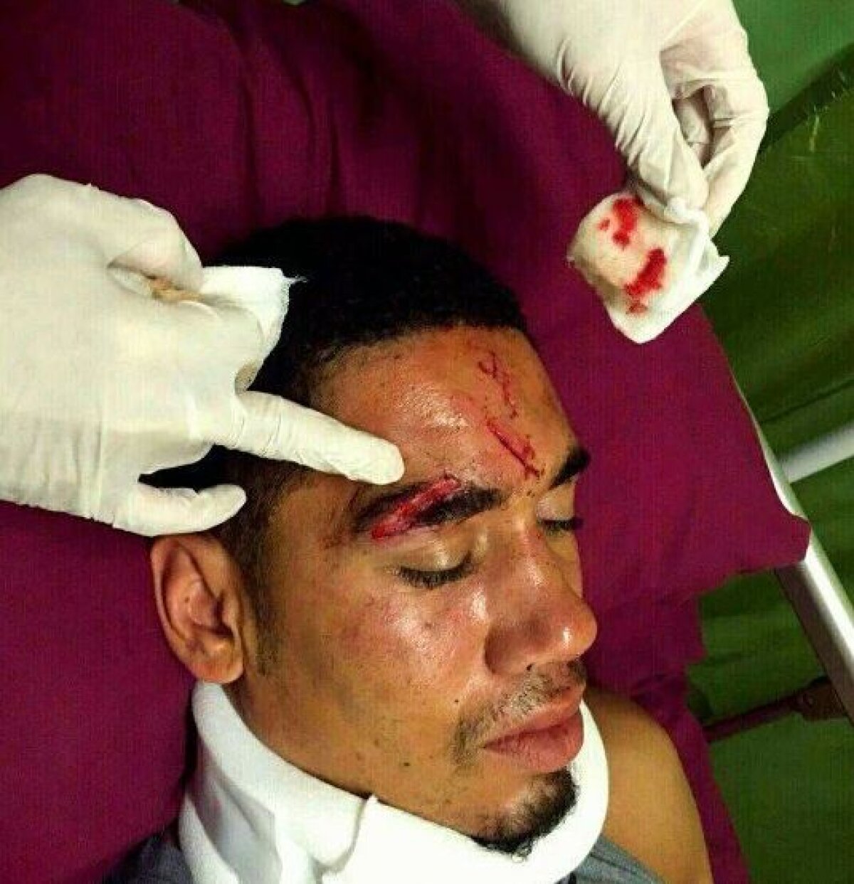 FOTO Accidentat în vacanță » Smalling s-a lovit grav în timp ce făcea surf