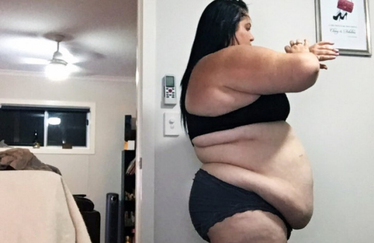 O femeie de 28 de ani avea 170 de kilograme. Ce a urmat a uimit întreaga lume