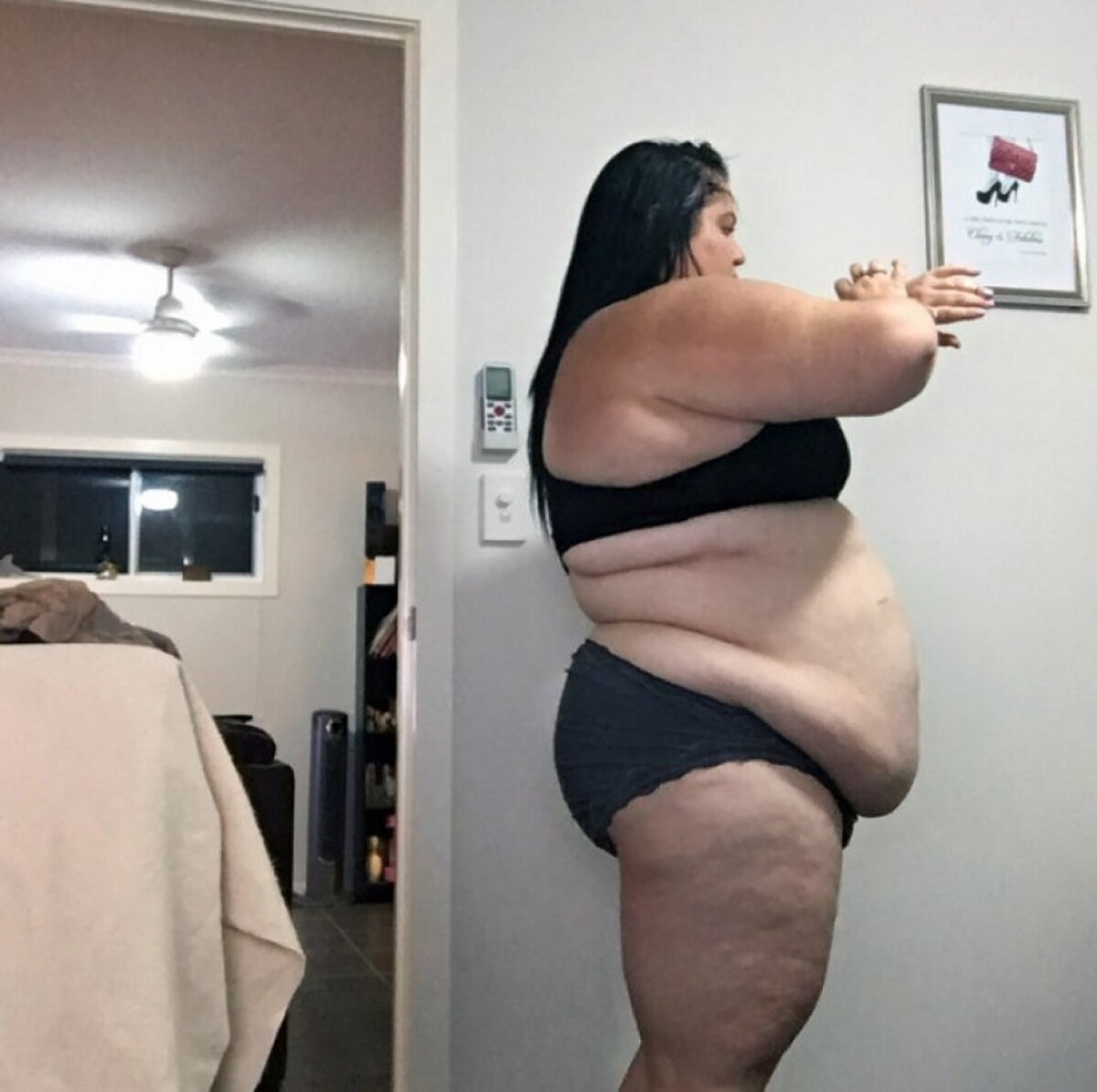 O femeie de 28 de ani avea 170 de kilograme. Ce a urmat a uimit întreaga lume