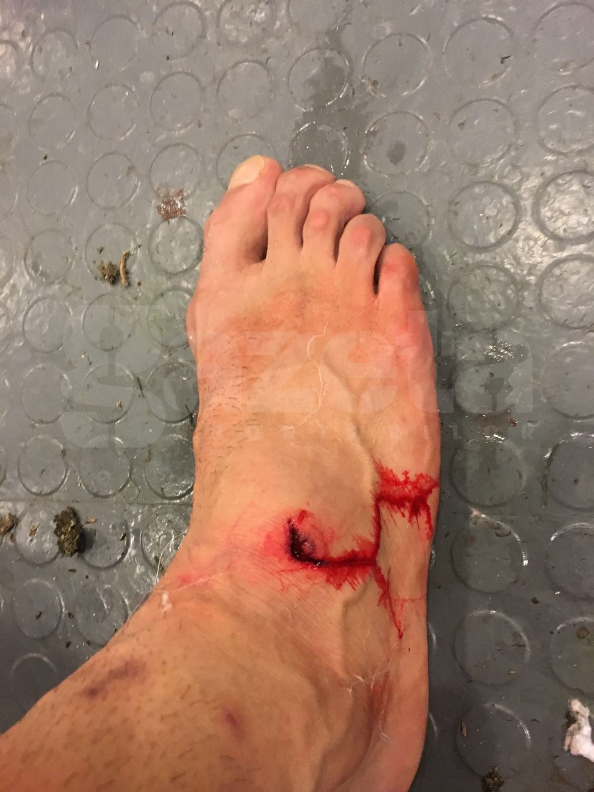 EXCLUSIV Accidentare horror pentru Daniel Niculae »  "Am văzut sânge pe gheată și îmi amorțise piciorul" » Cât lipsește