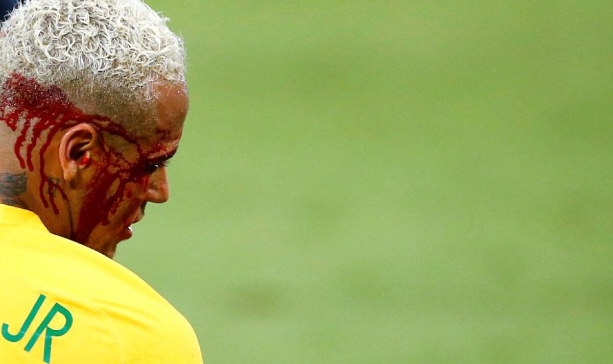 GALERIE FOTO + VIDEO Imagini horror » Neymar a fost umplut de sânge de un adversar!