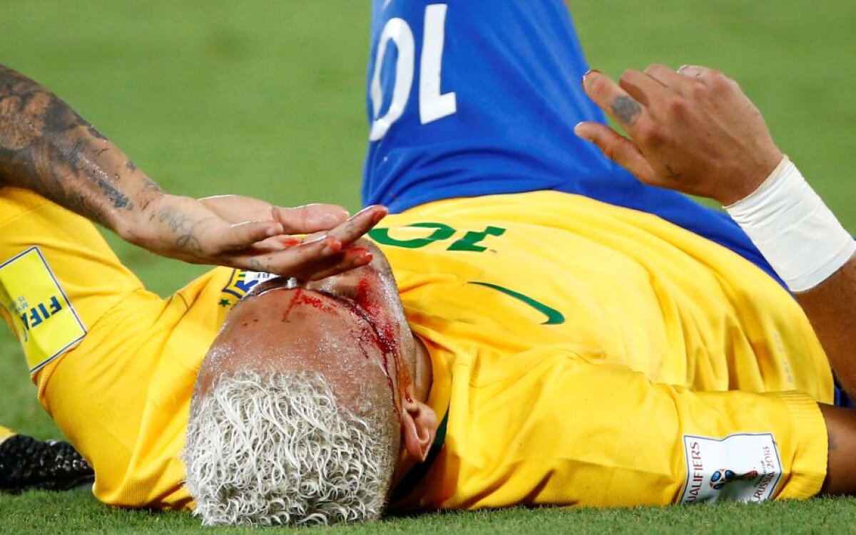 GALERIE FOTO + VIDEO Imagini horror » Neymar a fost umplut de sânge de un adversar!