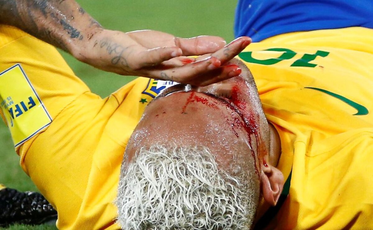 GALERIE FOTO + VIDEO Imagini horror » Neymar a fost umplut de sânge de un adversar!