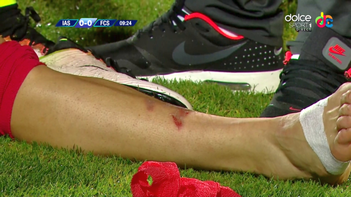 IMAGINI HORROR! Intrare criminală în Iași - Steaua! Jucătorul Stelei a fost schimbat IMEDIAT! EXCLUSIV! Cât va lipsi de pe teren și care e verdictul medicului după control