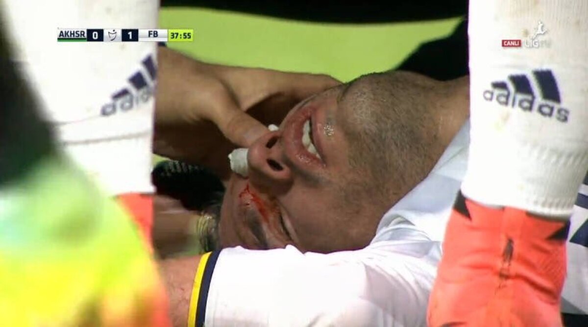 VIDEO + FOTO Accidentare horror pentru Van Persie! Și-ar putea pierde un ochi