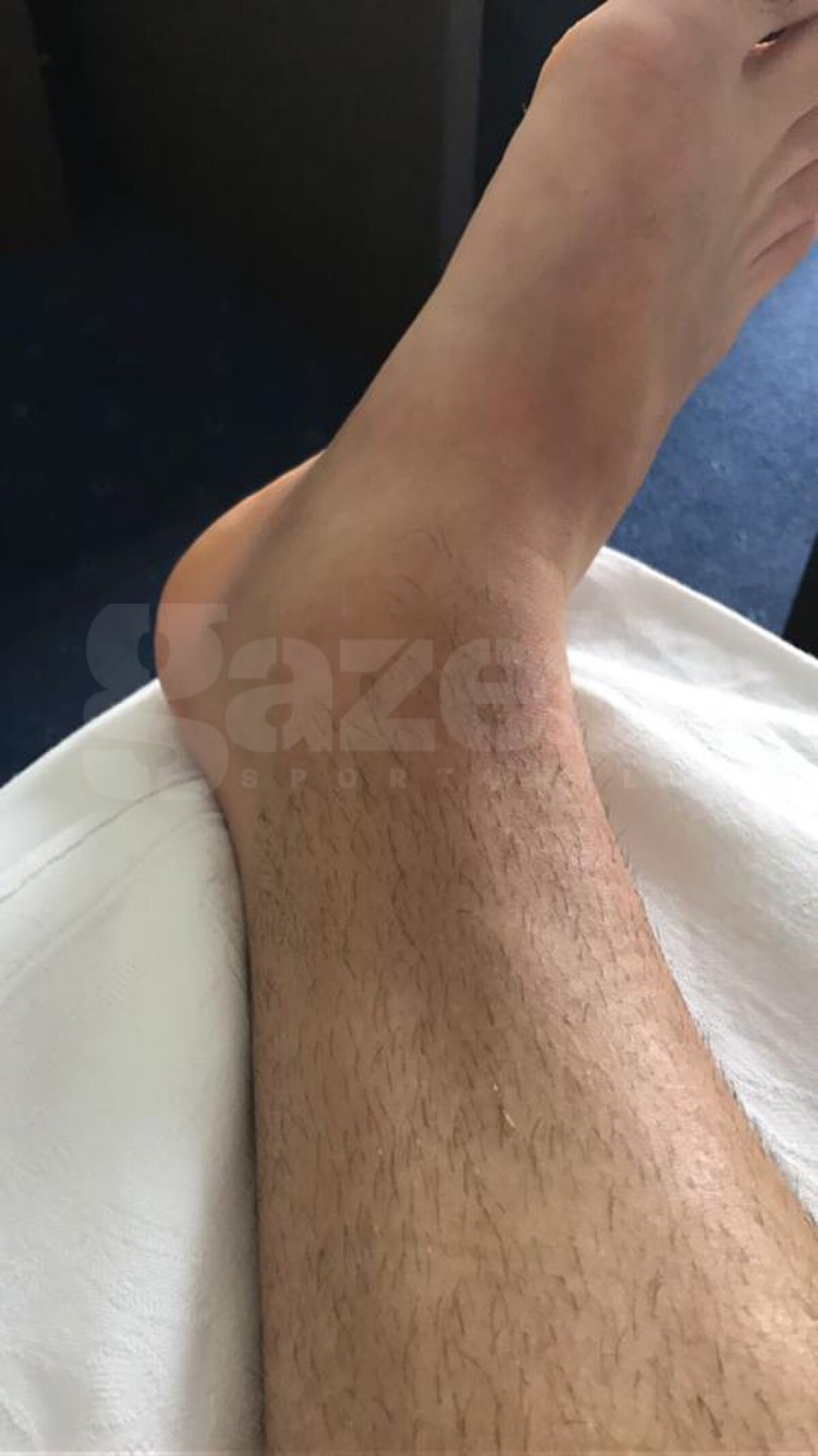 FOTO Ivan răspunde în scandalul fotbaliștilor care au abandonat naționala » Dovada că accidentarea sa este reală și că va rata meciul cu Astra