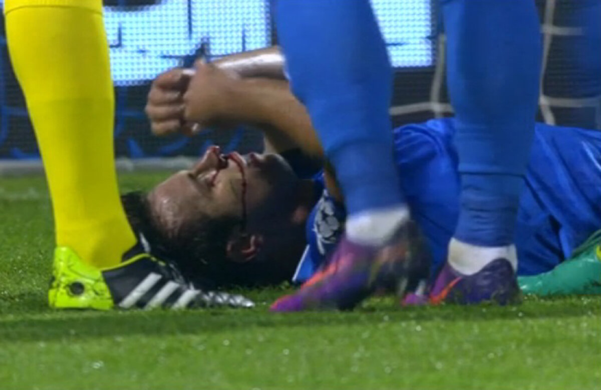 FOTO Plin de sânge! Fractură! Mățel a primit o lovitură dură la un duel aerian