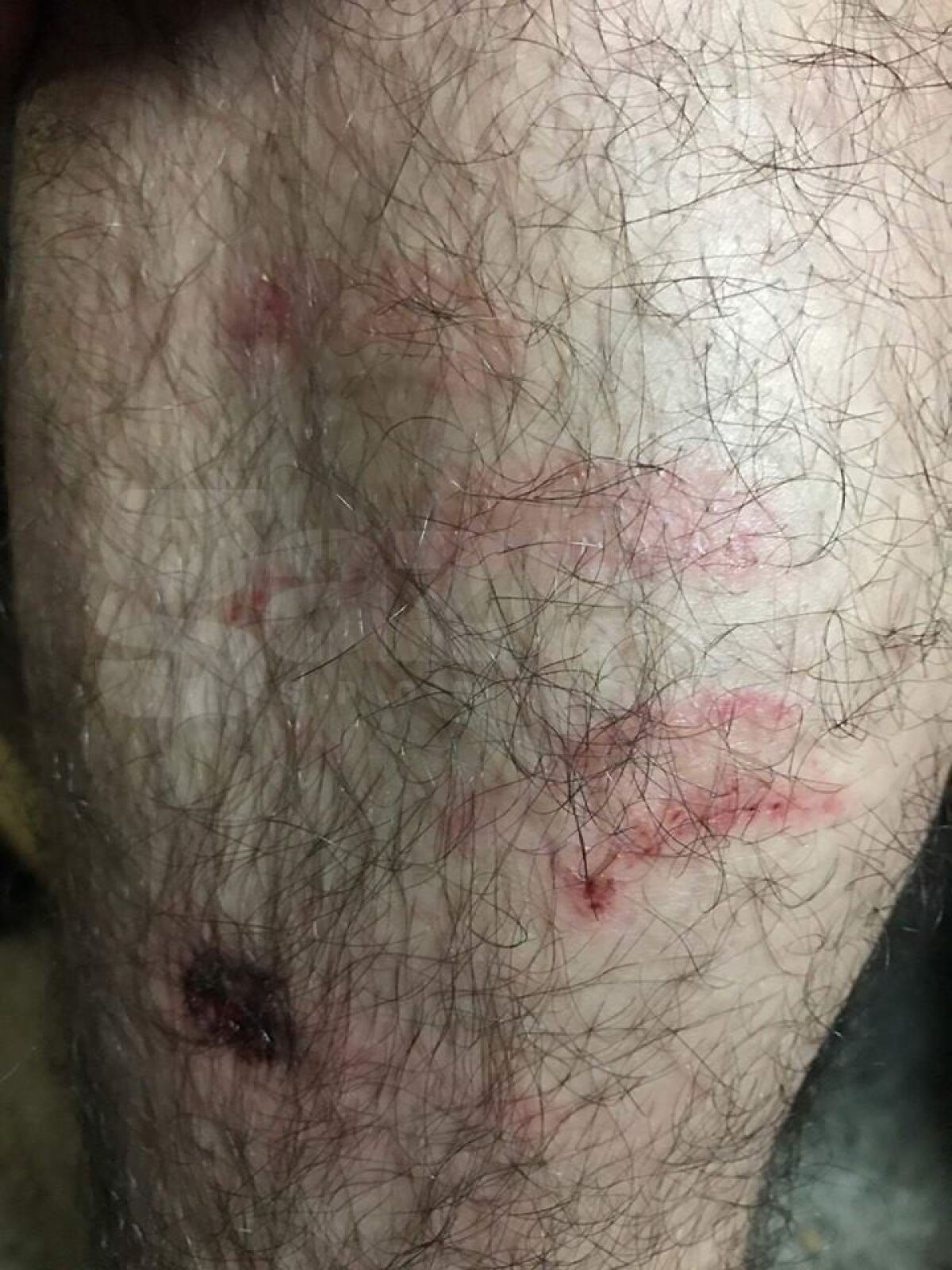 FOTO EXCLUSIV Scandal în Anglia: "Românii? Niște laşi! Simulează, plâng, scuipă şi ciupesc" » FC România acuză că e persecutată: "Doar pentru că vorbim altă limbă"