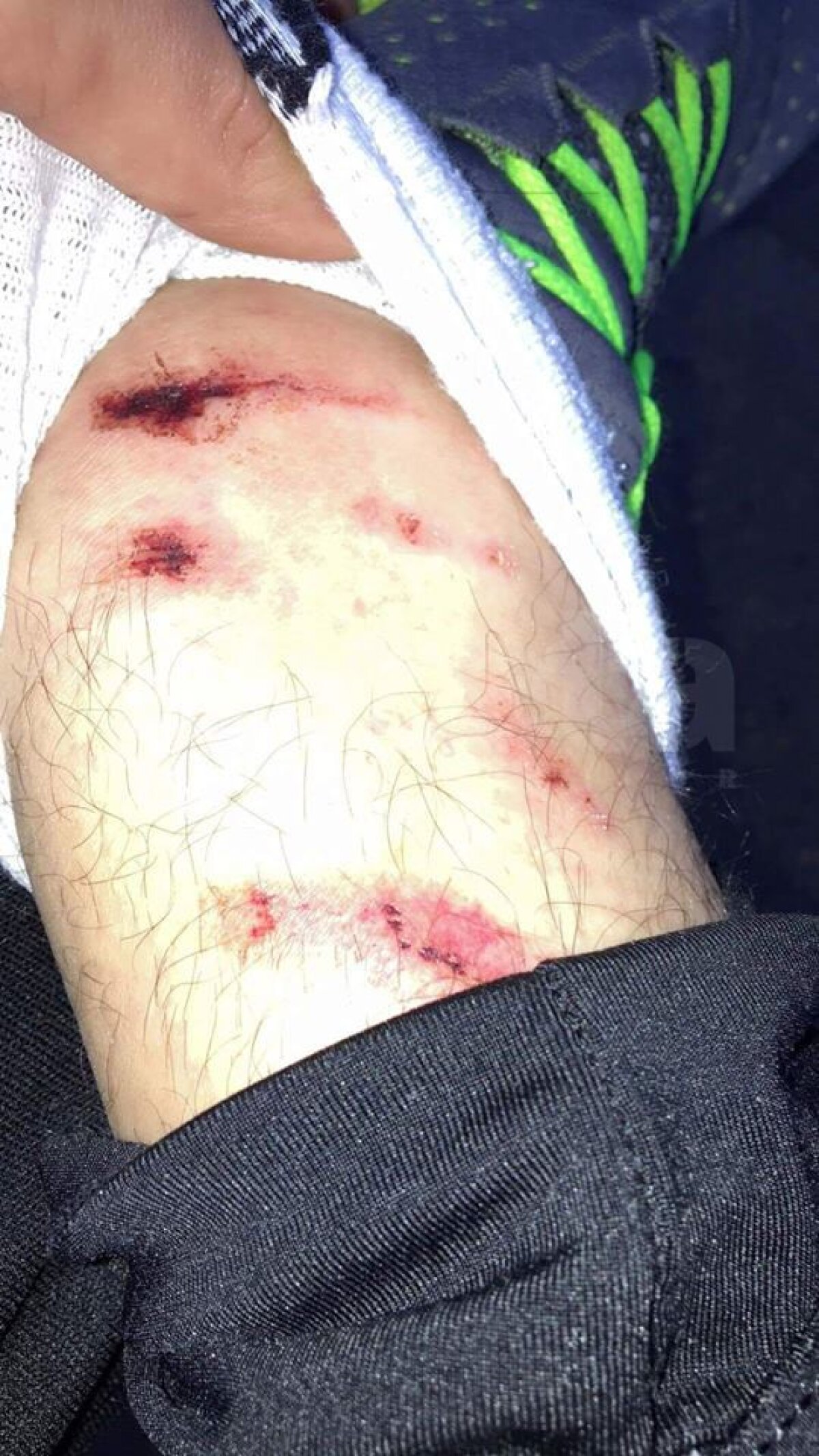 FOTO EXCLUSIV Scandal în Anglia: "Românii? Niște laşi! Simulează, plâng, scuipă şi ciupesc" » FC România acuză că e persecutată: "Doar pentru că vorbim altă limbă"