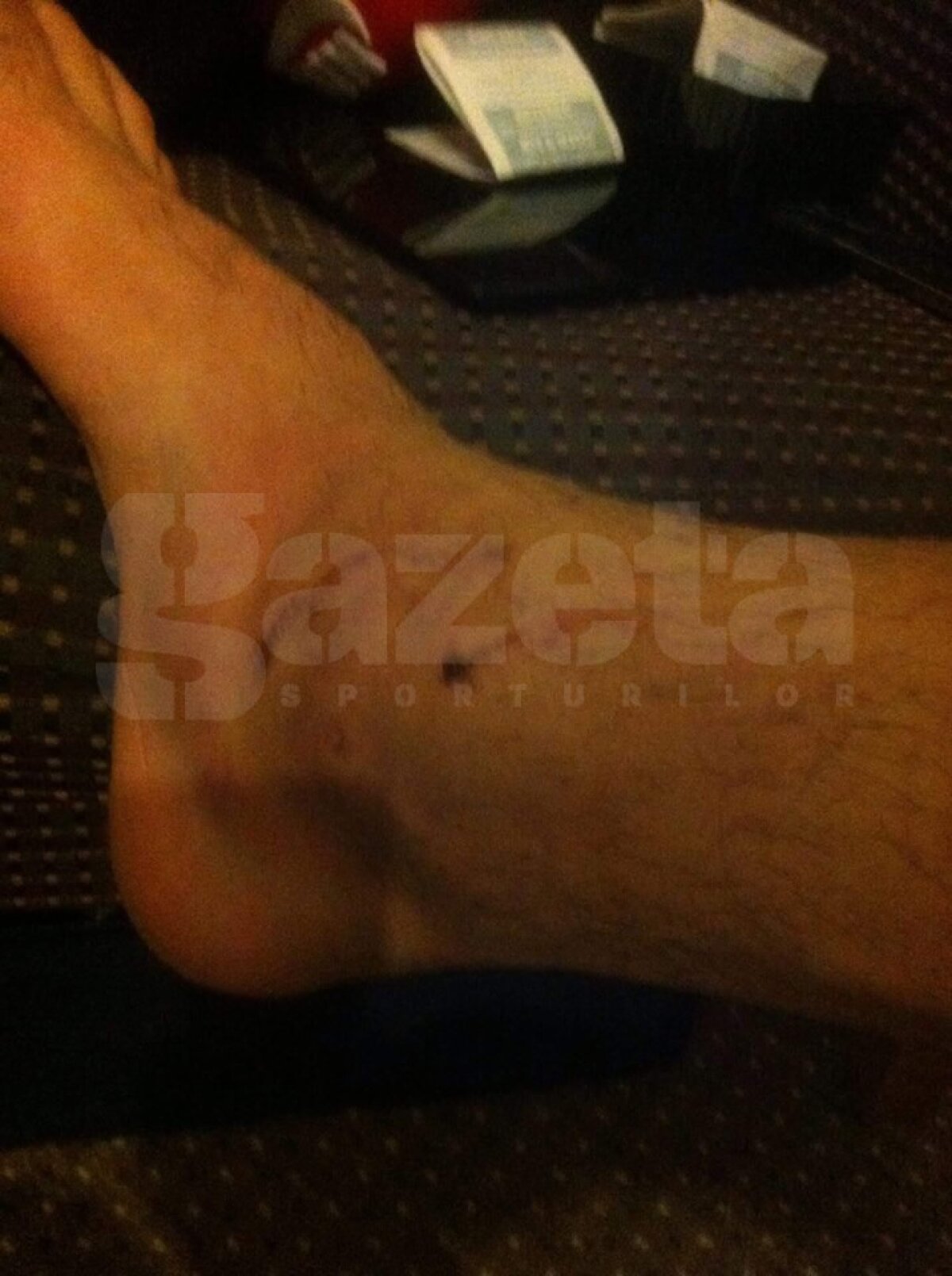 FOTO EXCLUSIV Scandal în Anglia: "Românii? Niște laşi! Simulează, plâng, scuipă şi ciupesc" » FC România acuză că e persecutată: "Doar pentru că vorbim altă limbă"