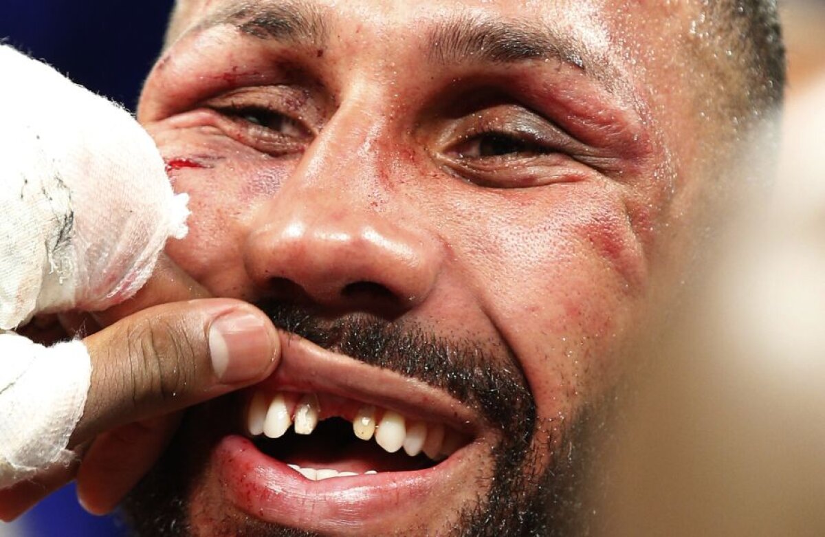 Scandal și dinți rupți » Cum a fost înfruntarea James De Gale - Badou Jack, meciul pentru unificarea centurilor IBF şi WBC. Mayweather: "Furt pe față!"