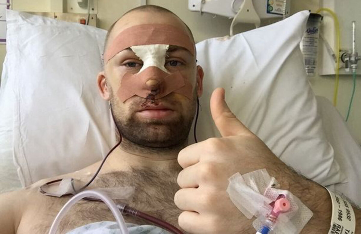 FOTO Jucător lovit în cap cu o minge, a suferit 15 fracturi! Atenție, imagini HORROR