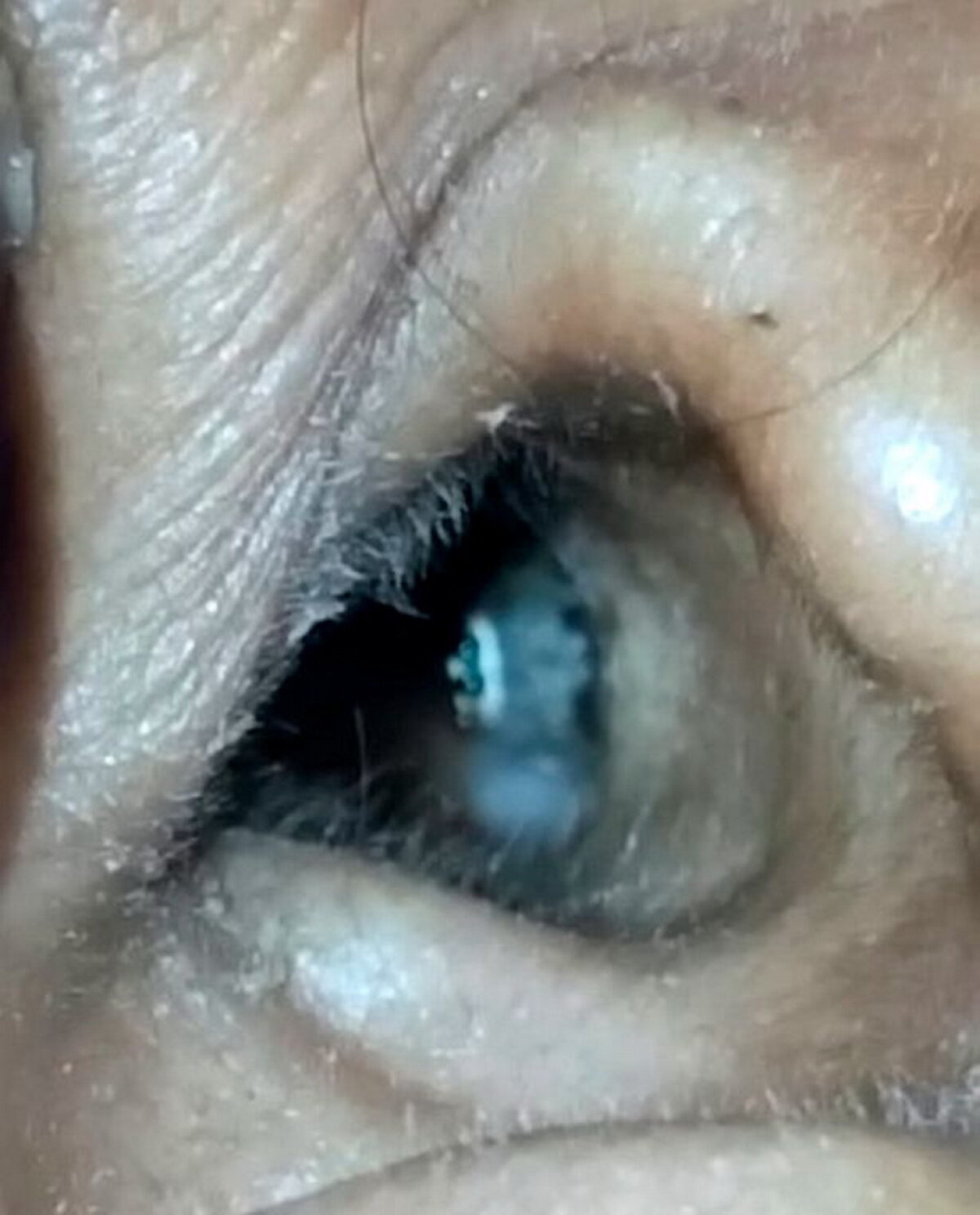 VIDEO & FOTO O femeie a adormit pe terasă, însă la scurt timp a ajuns de urgenţă la spital. E incredibil ce i s-a întâmplat!