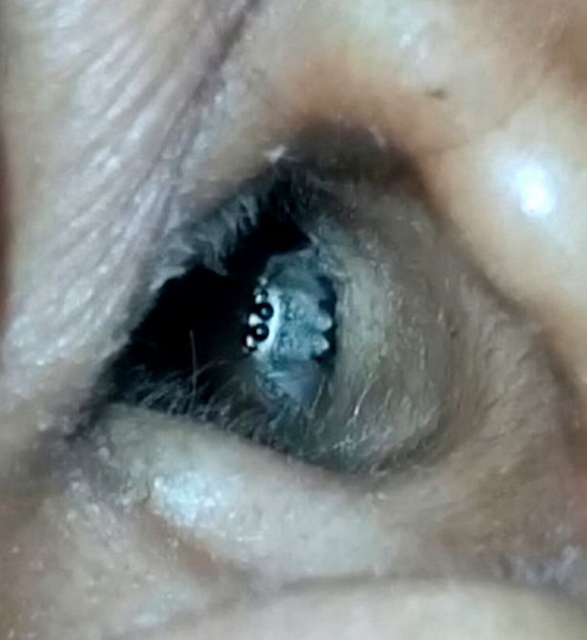 VIDEO & FOTO O femeie a adormit pe terasă, însă la scurt timp a ajuns de urgenţă la spital. E incredibil ce i s-a întâmplat!