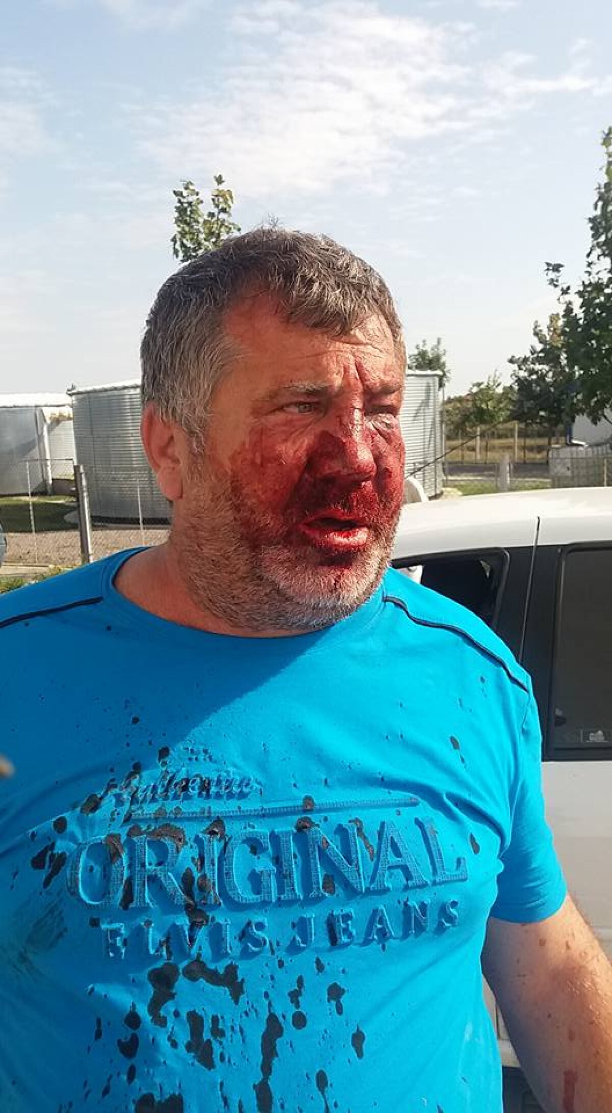 FOTO Atenție, imagini cu puternic impact emoțional! » Un antrenor din L4 Giurgiu a fost umplut de sânge de rudele unui fotbalist