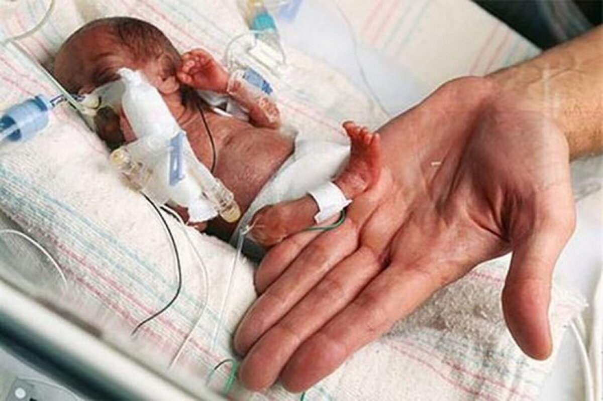 GALERIE FOTO & VIDEO S-a născut cu o greutate de 229 de grame. Ce s-a întâmplat cu fetița este impresionant!