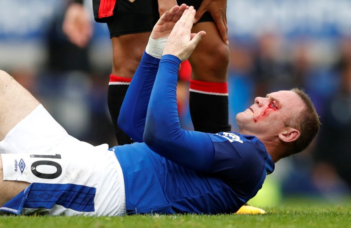 VIDEO + FOTO Imagini horror cu Rooney » Atacantul englez a fost umplut de sânge de un adversar