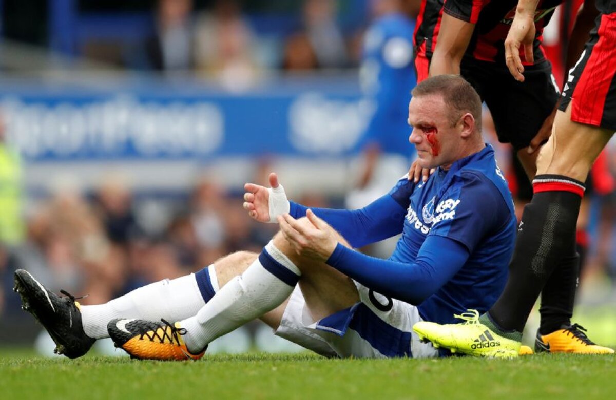 VIDEO + FOTO Imagini horror cu Rooney » Atacantul englez a fost umplut de sânge de un adversar