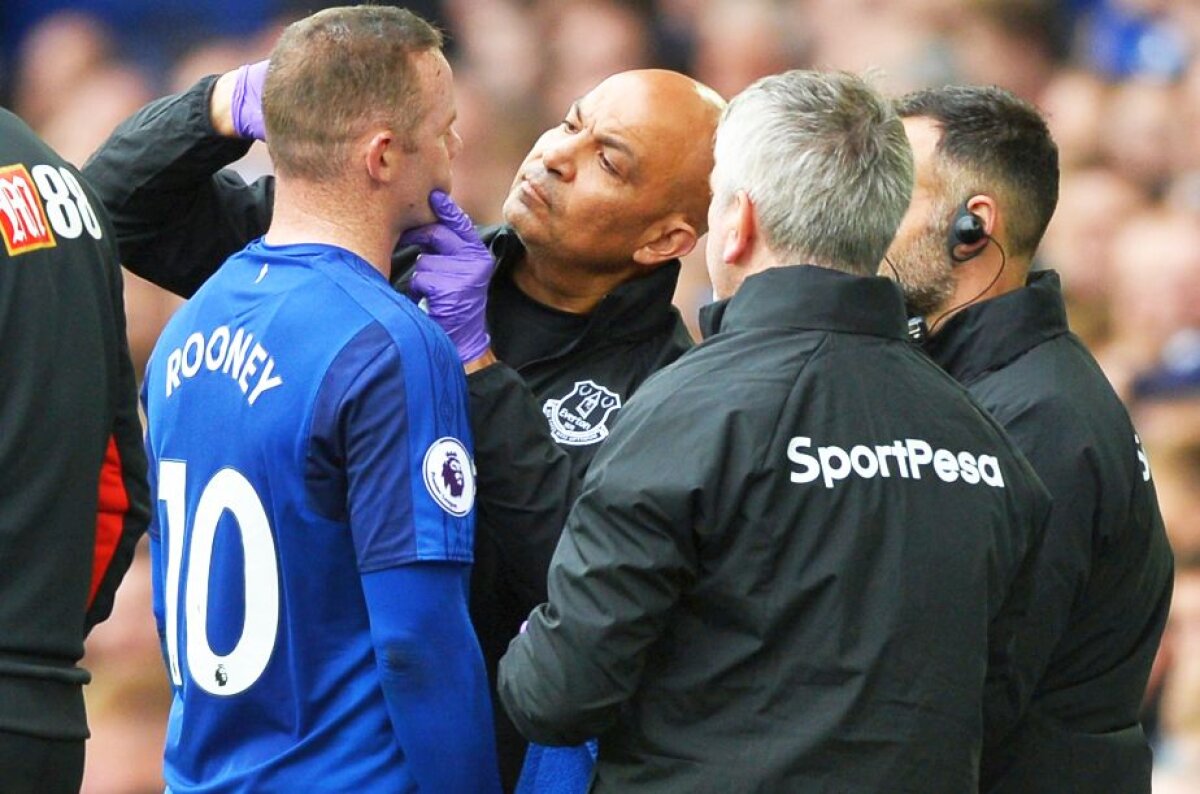 VIDEO + FOTO Imagini horror cu Rooney » Atacantul englez a fost umplut de sânge de un adversar