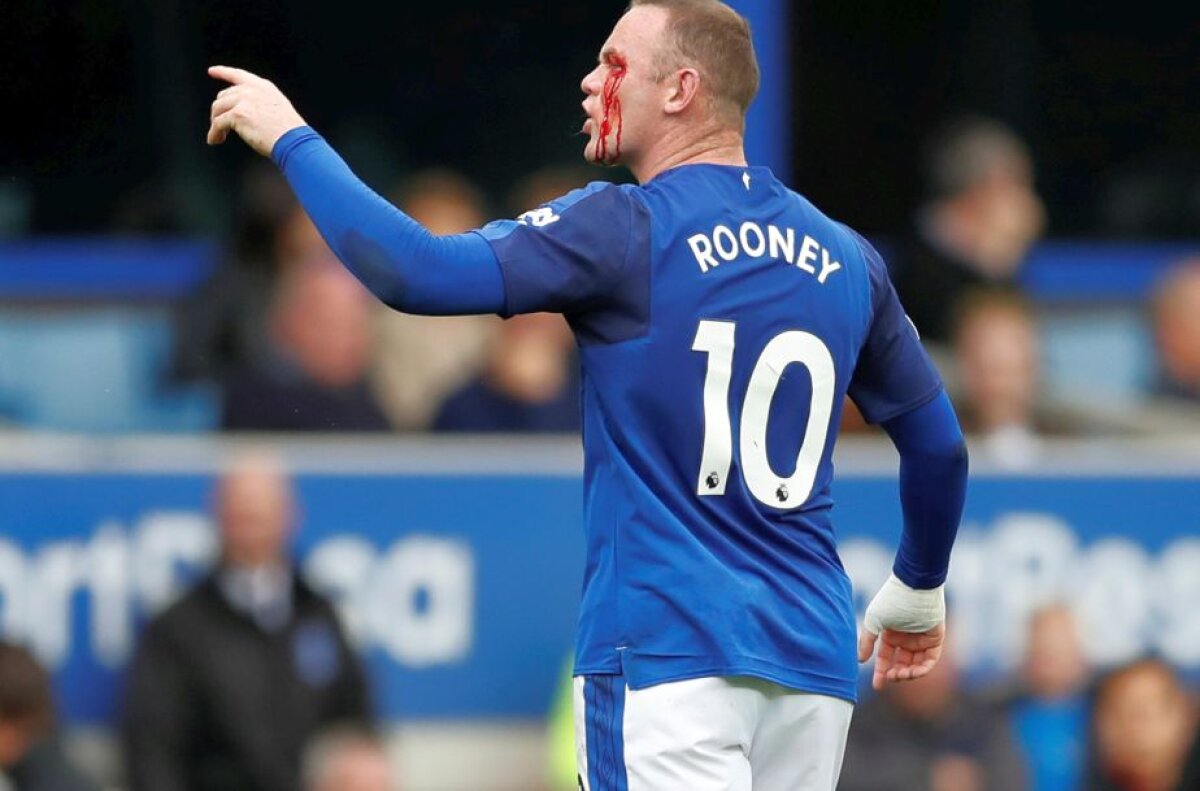 VIDEO + FOTO Imagini horror cu Rooney » Atacantul englez a fost umplut de sânge de un adversar