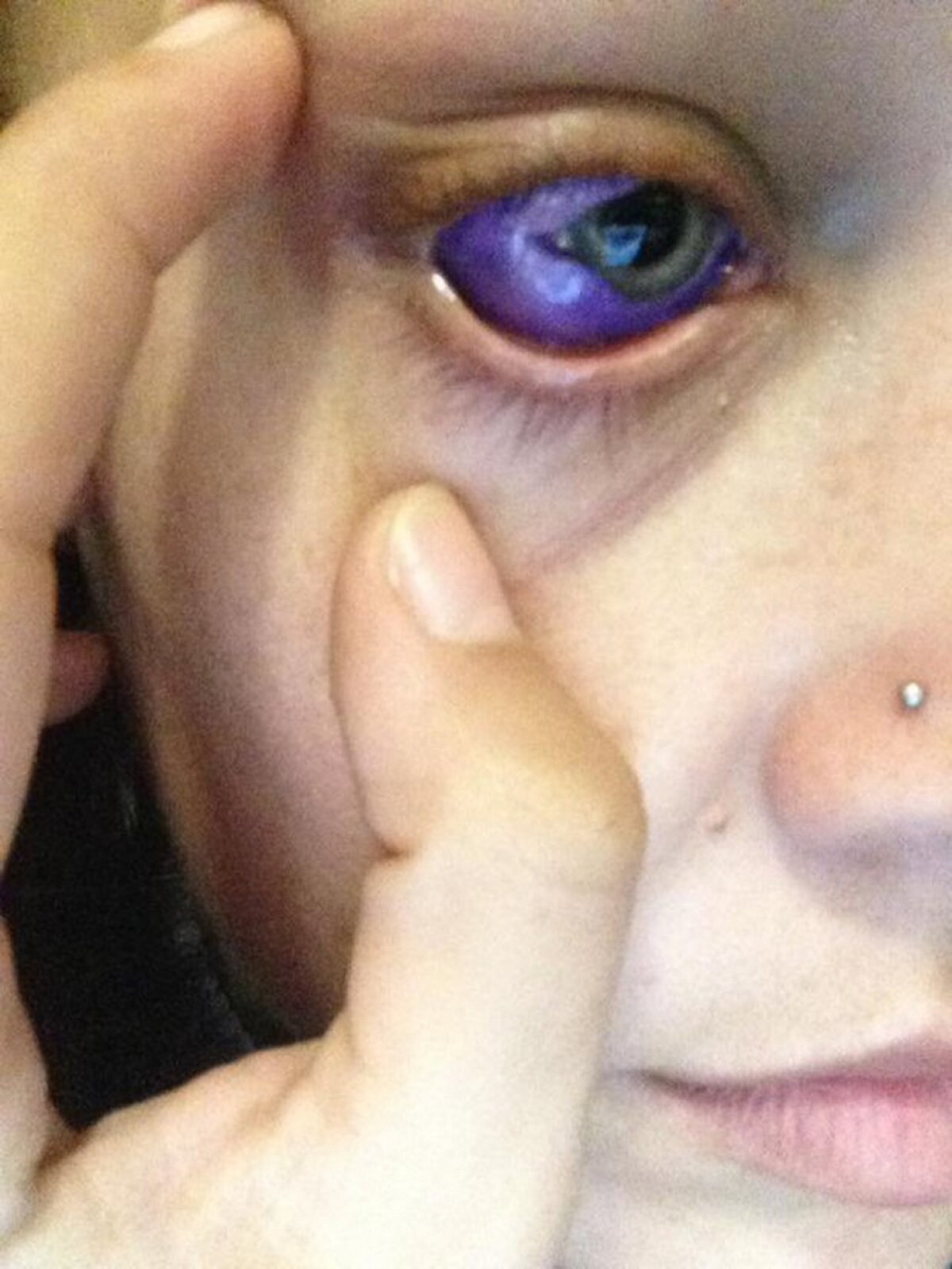 FOTO & VIDEO A vrut să îşi facă un tatuaj în ochi, însă ce a păţit este cu adevărat şocant!