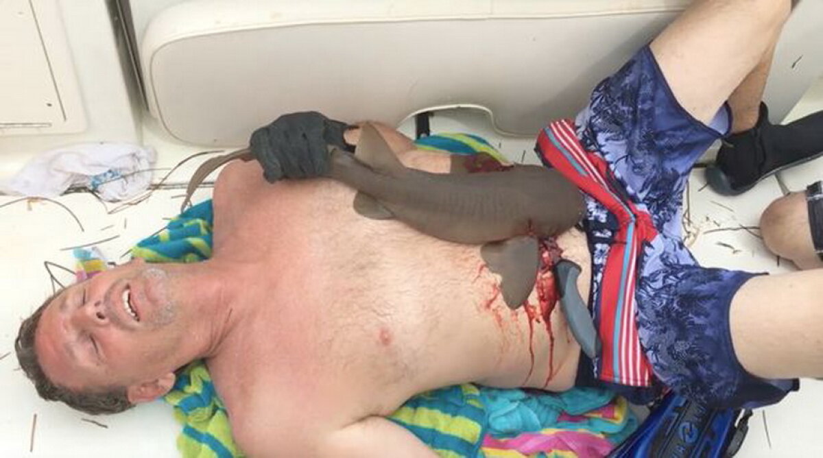 VIDEO Atenţie, imagini uluitoare. A ieşit din apă cu un rechin înfipt în abdomen!