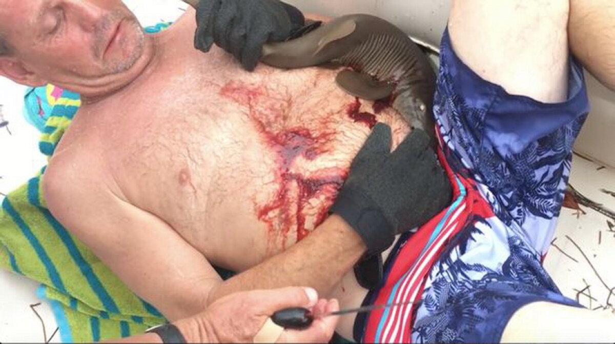 VIDEO Atenţie, imagini uluitoare. A ieşit din apă cu un rechin înfipt în abdomen!