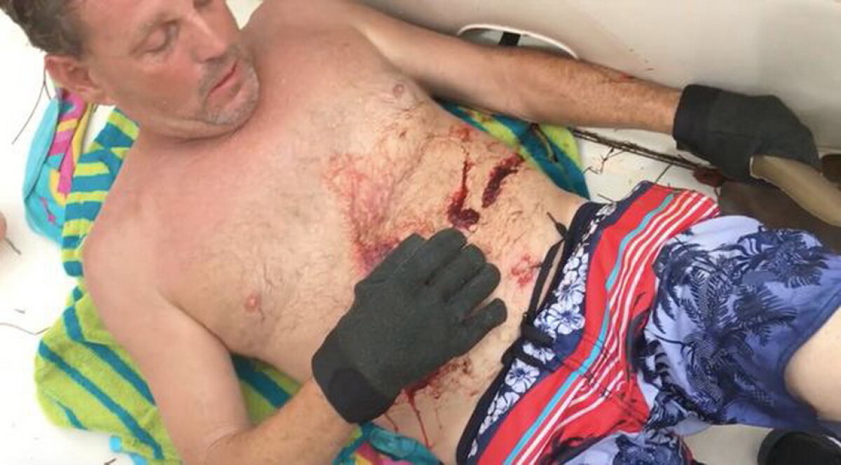 VIDEO Atenţie, imagini uluitoare. A ieşit din apă cu un rechin înfipt în abdomen!