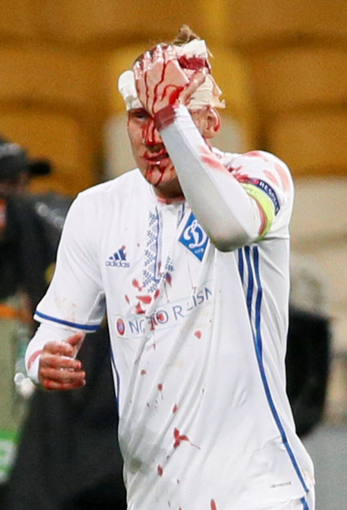 Acoperit cu sânge » Un jucător din Europa League a ieșit de pe teren ca după război
