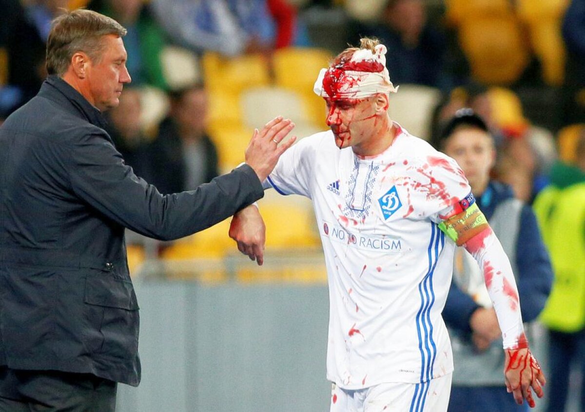 Acoperit cu sânge » Un jucător din Europa League a ieșit de pe teren ca după război