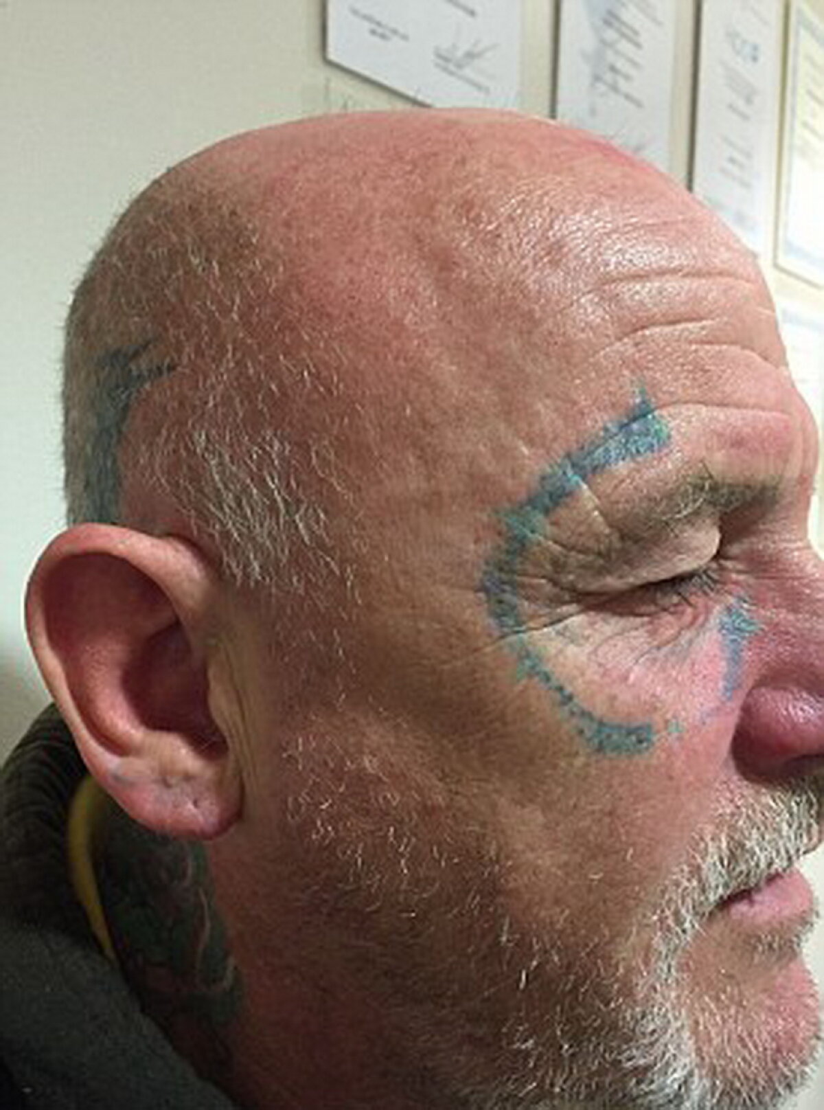 Cea mai mare nebunie făcută la o petrecere! Este incredibil ce a păţit un bărbat!