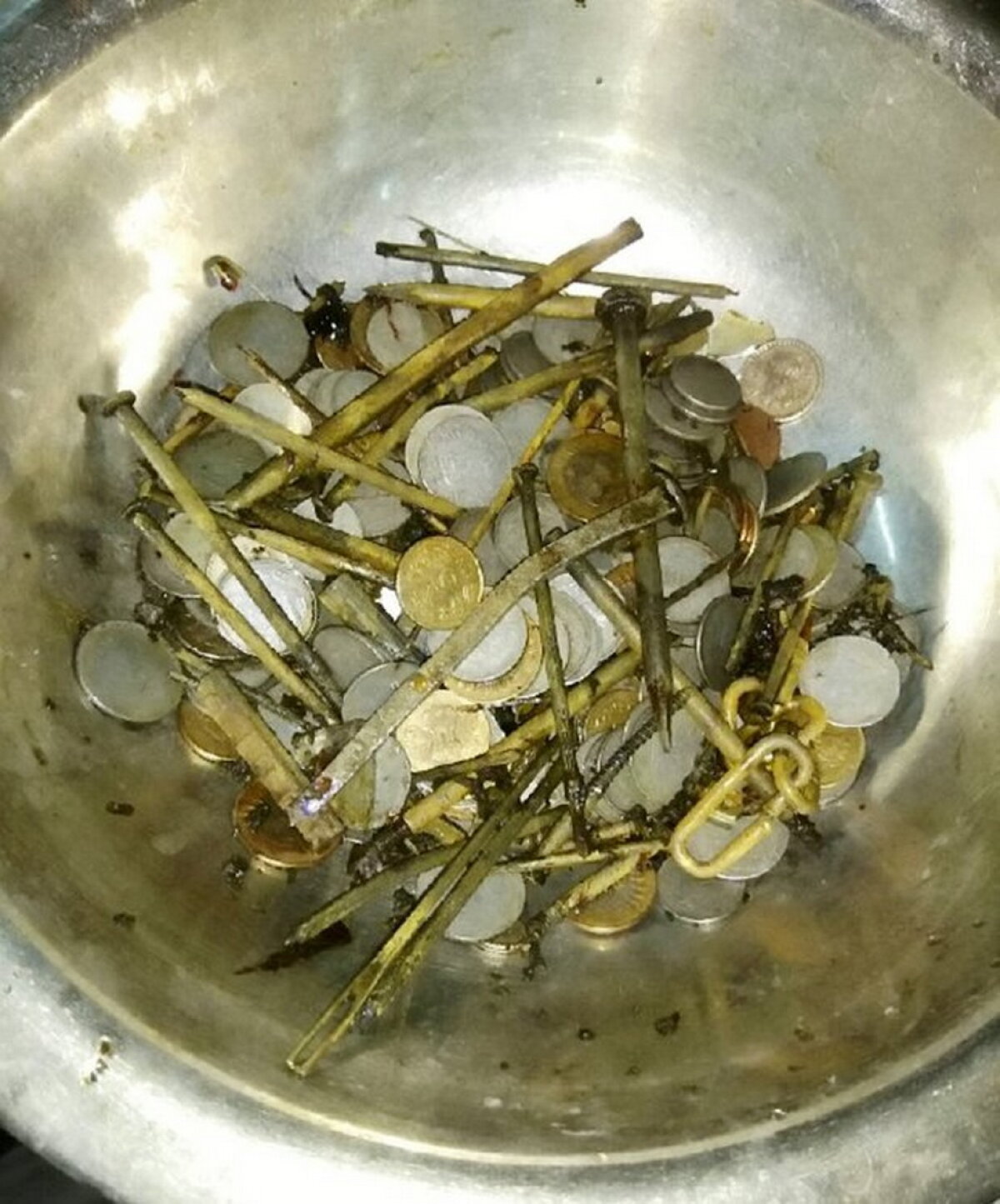 FOTO Medicii au fost şocaţi când au văzut ce are în stomac un bărbat din India!