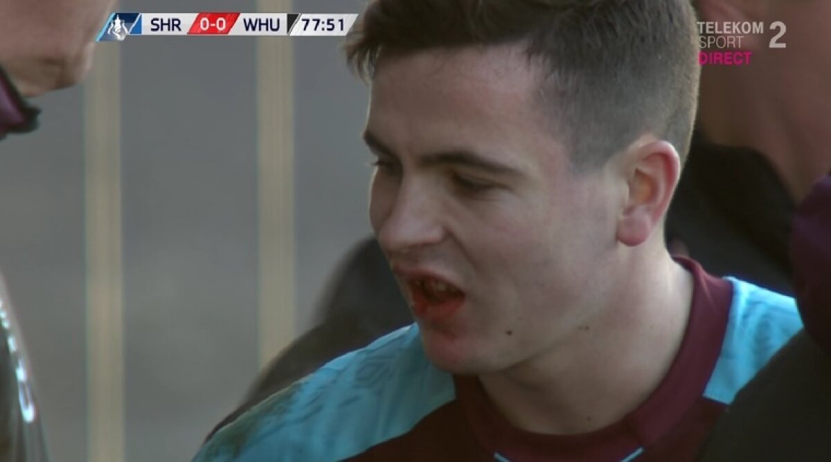 VIDEO + FOTO Secvențe cumplite în Cupa Angliei: i-au sărit dinții din gură!