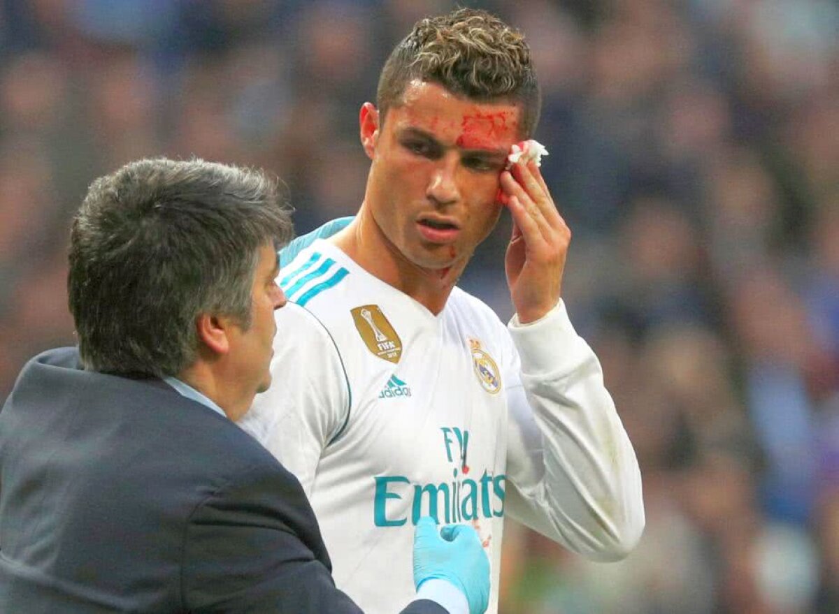 VIDEO+FOTO » Selfie plin de sânge în Real Madrid-Deportivo! Imagini horror cu Cristiano Ronaldo, care a cerut un telefon să vadă unde e tăiat la față