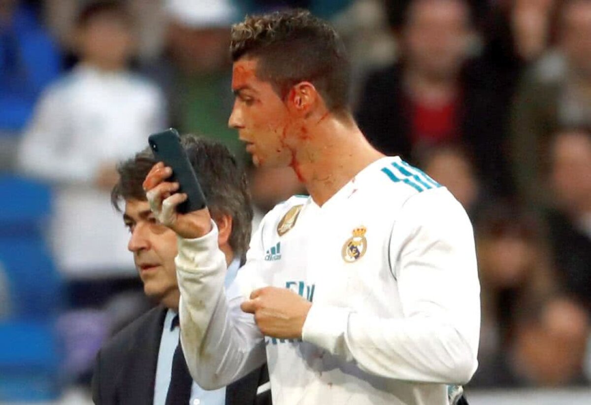 VIDEO+FOTO » Selfie plin de sânge în Real Madrid-Deportivo! Imagini horror cu Cristiano Ronaldo, care a cerut un telefon să vadă unde e tăiat la față
